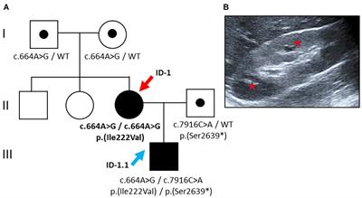 Challenging Disease Ontology by Instances of Atypical PKHD1 and PKD1 Genetics